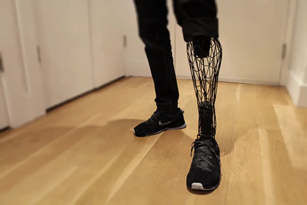 Inovasi teknologi terkini dan tercanggih di dunia - 3D Printed Prosthetics