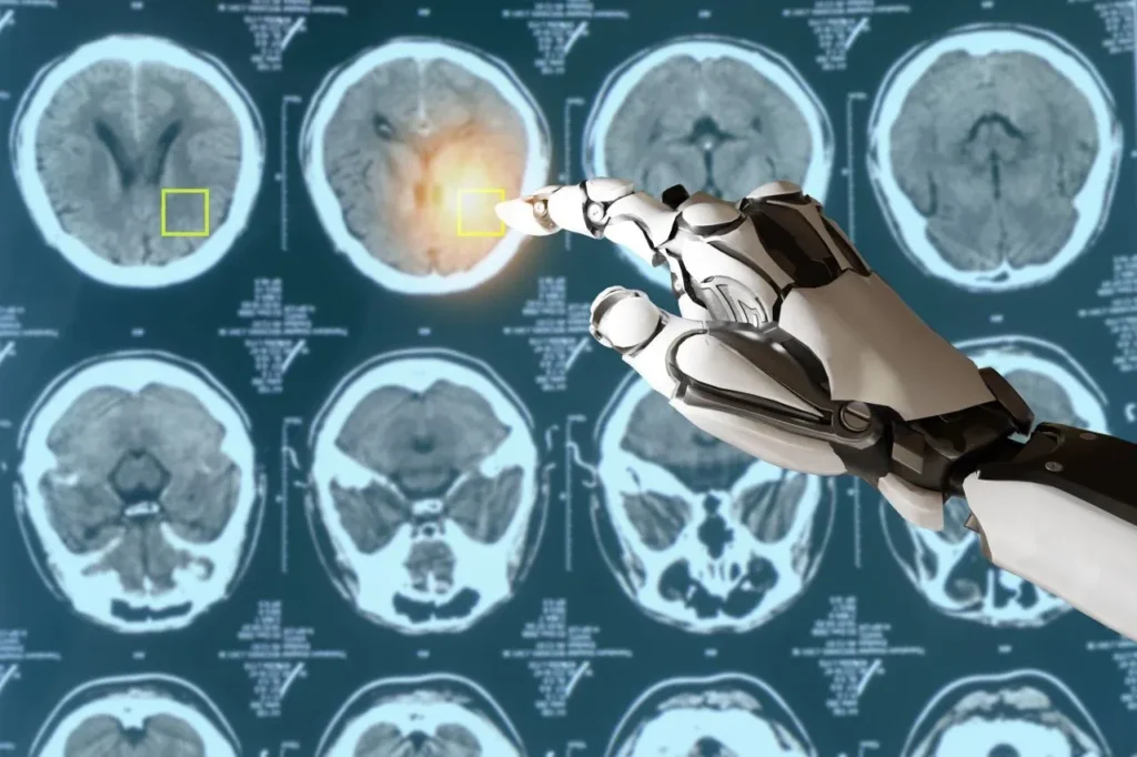 Inovasi teknologi Terkini dan Tercanggih: Artificial Intelligence (AI) - Medical Diagnosis