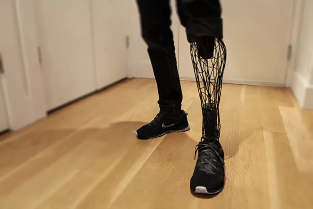 Inovasi teknologi Terkini dan Tercanggih: 3D Printed Prosthetics